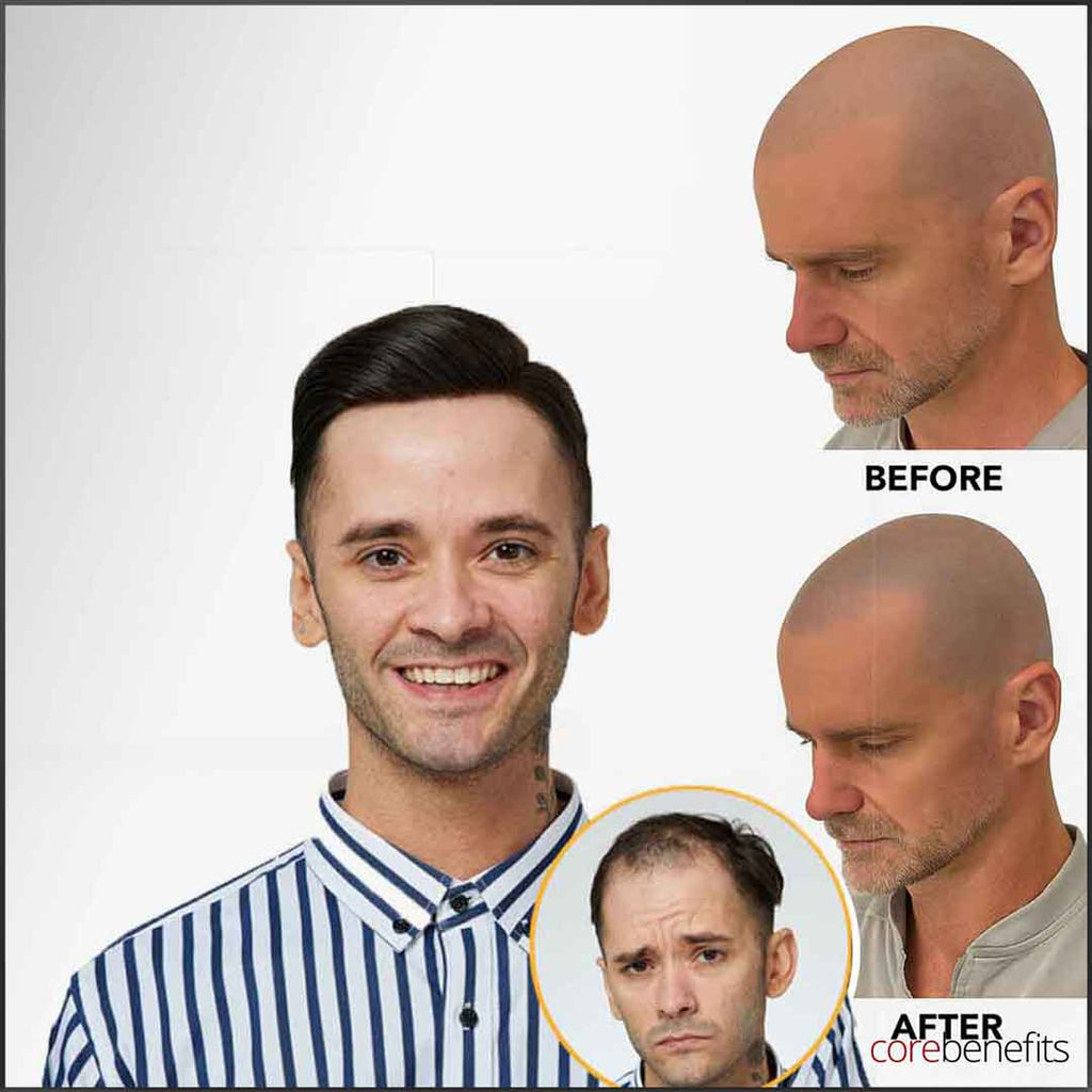 Hair System vs SMP: What’s Right for You? - Core Benefits Toowoomba