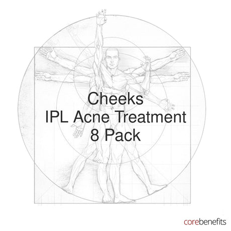 8 pack of Cheeks IPL Acne Treatment treatments at Core Benefits Toowoomba