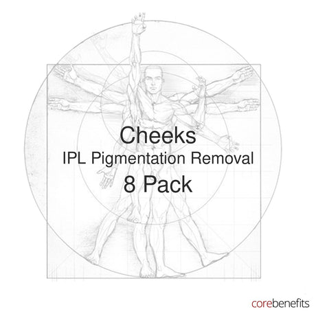 8 pack of Cheeks IPL Pigmentation Removal treatments at Core Benefits Toowoomba