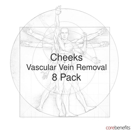 8 pack of Cheeks Vascular Vein Removal treatments at Core Benefits Toowoomba