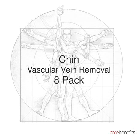 8 pack of Chin Vascular Vein Removal treatments at Core Benefits Toowoomba