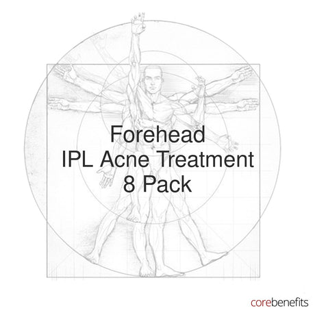 8 pack of Forehead IPL Acne Treatment treatments at Core Benefits Toowoomba