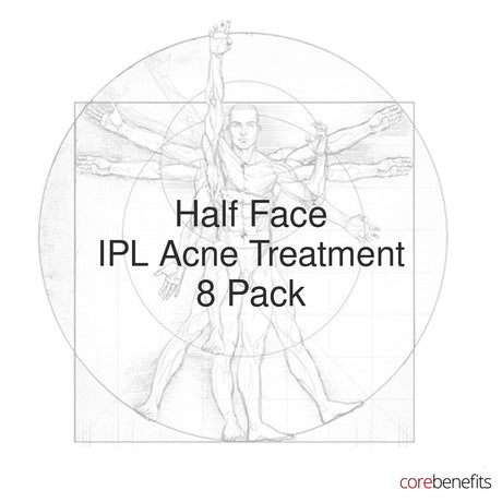 8 pack of Half Face IPL Acne Treatment treatments at Core Benefits Toowoomba