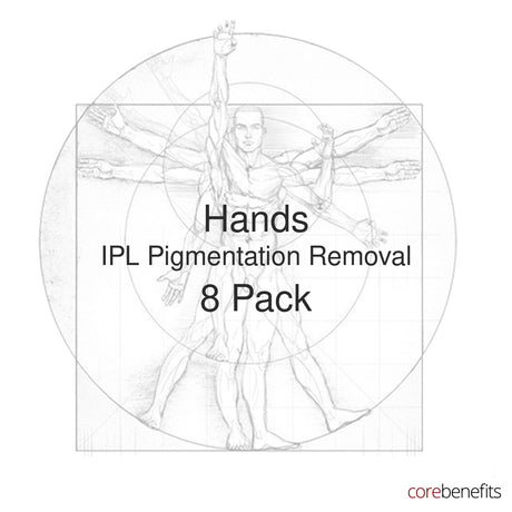8 pack of Hands IPL Pigmentation Removal treatments at Core Benefits Toowoomba