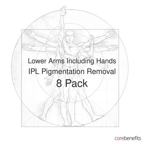 8 pack of Lower Arms Including Hands IPL Pigmentation Removal treatments at Core Benefits Toowoomba
