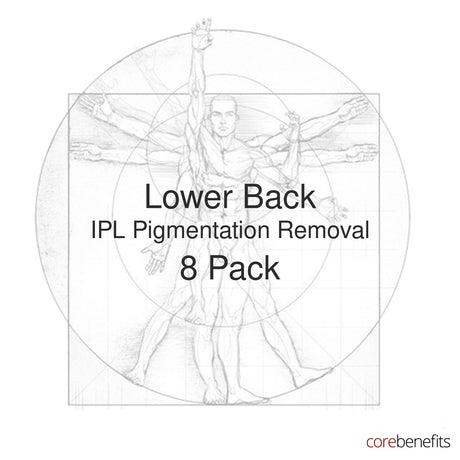 8 pack of Lower Back IPL Pigmentation Removal treatments at Core Benefits Toowoomba