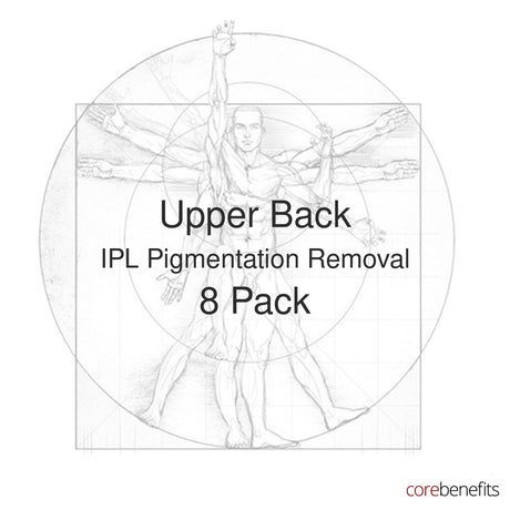 8 pack of Upper Back IPL Pigmentation Removal treatments at Core Benefits Toowoomba