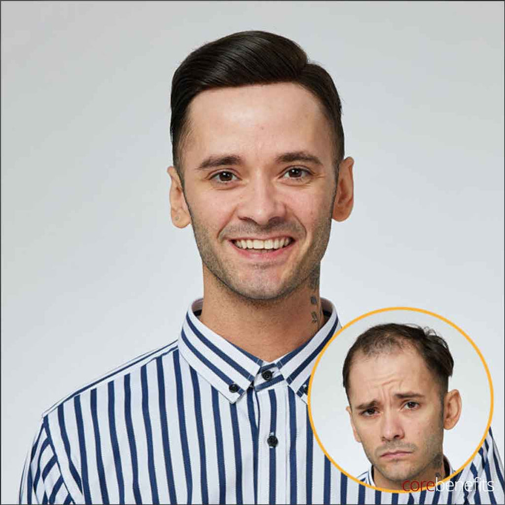 The Australian Men’s Hair System | Swiss Lace & PU Perimeter - Core Benefits Toowoomba - Hair System