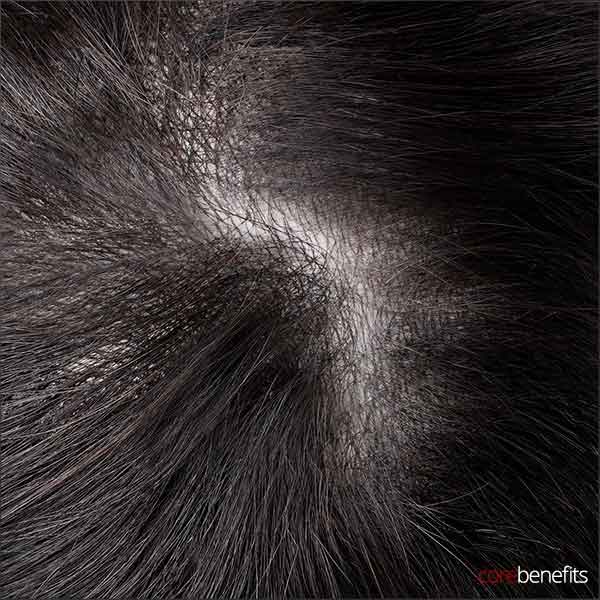 Top view of The Dominator Hair System, a men's hair piece by Core Benefits Toowoomba, revealing the superior scalp coverage and undetectable thin skin base at 0.06mm thickness. This men's toupee offers a natural look for hair replacement.